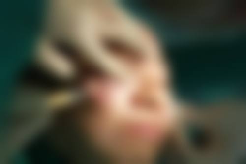 张哲团队擅长的医美项目