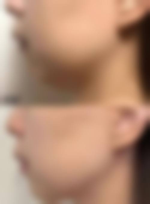 合肥淑美医疗美容诊所怎么样来院路线