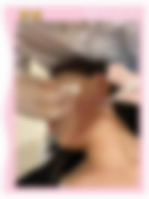 抚州金溪甘建东医疗美容皮肤诊所怎么样特色项目及技术优势