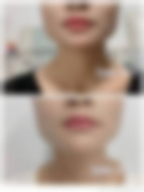 郑州艺龄医疗美容门诊部怎么样价格收费