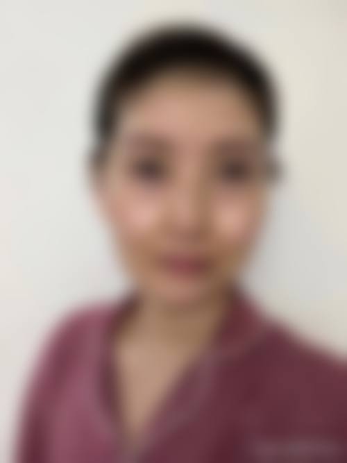 北京大学第一医院整形科怎么样求美者反馈