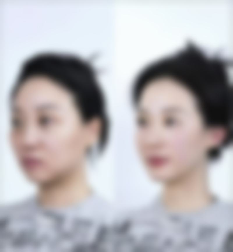 吉林元美整形医院怎么样来院路线