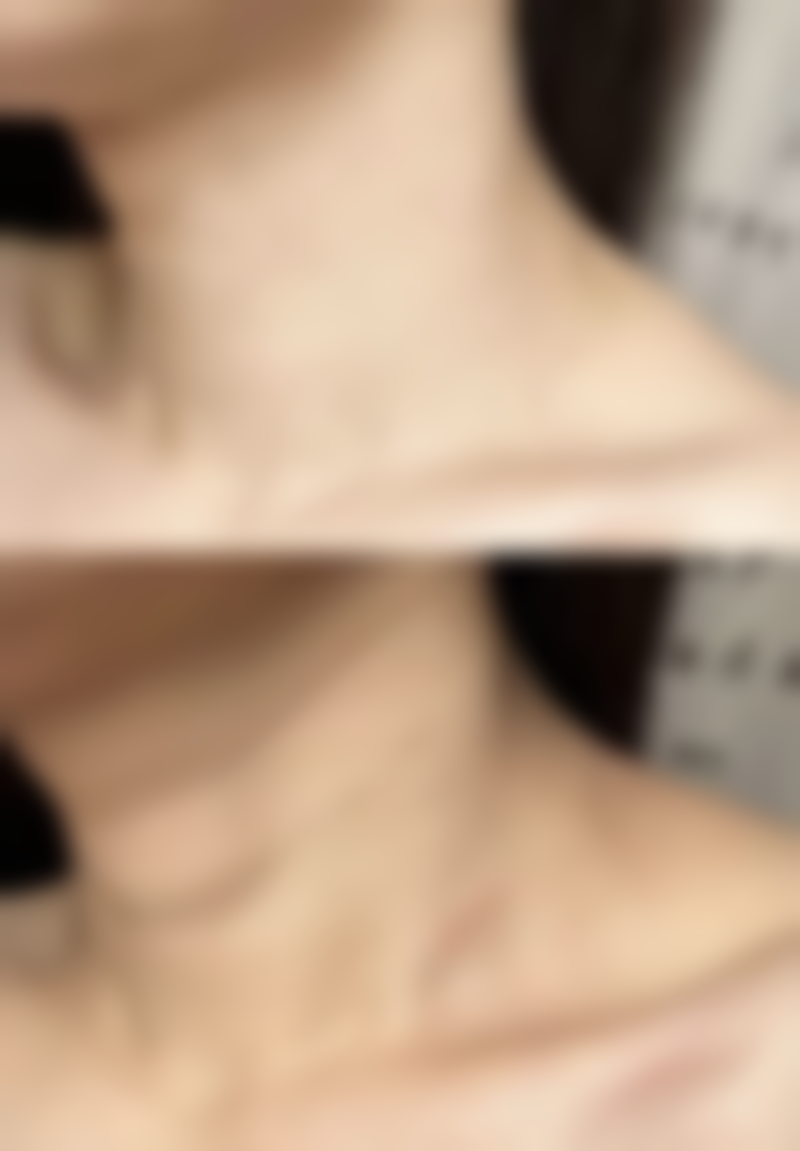 冈山TA Clinic怎么样求美者反馈