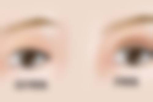 郭建滨医生助力美丽人生