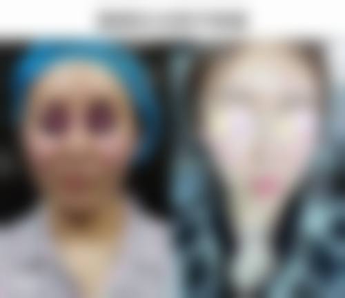 茶陵县人民医院怎么样简介概述