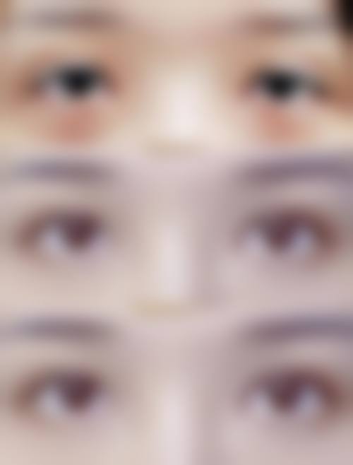 Preecha Tiewtranon 擅长的医美领域