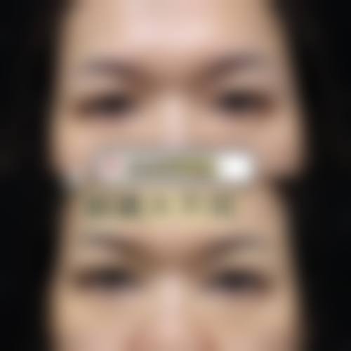 熊伟汉医生的个性化方案