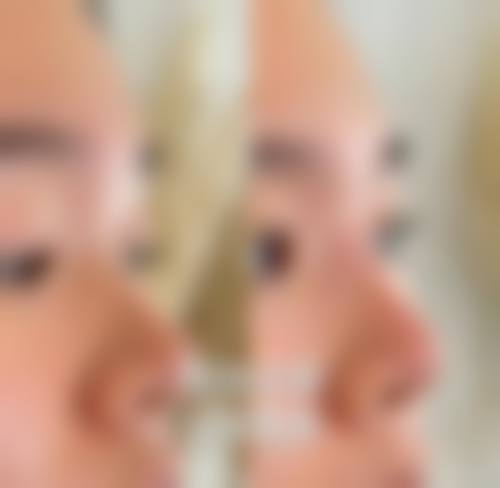 韩国THANKYOU整形外科怎么样来院路线