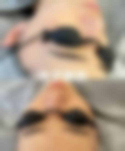 临沂瑞丽美容医院如何怎么样医生团队实力