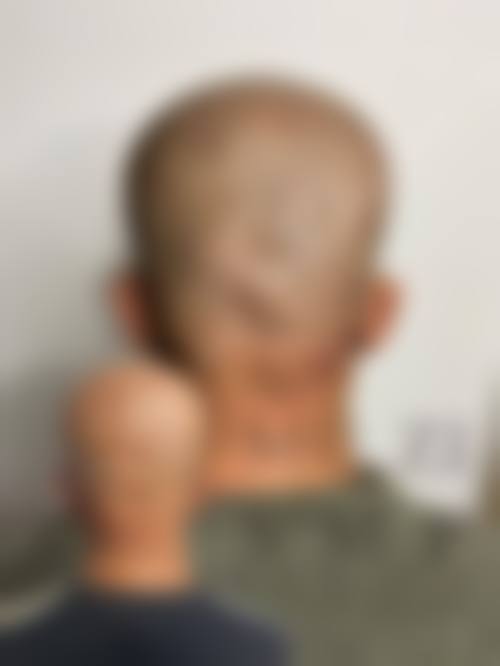 选择蔡允剑医生的理由