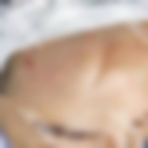 厦门碧莲盛无痕植发整形怎么样基本信息