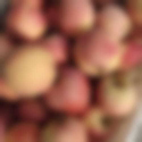 厦门碧莲盛无痕植发整形怎么样特色项目及技术优势