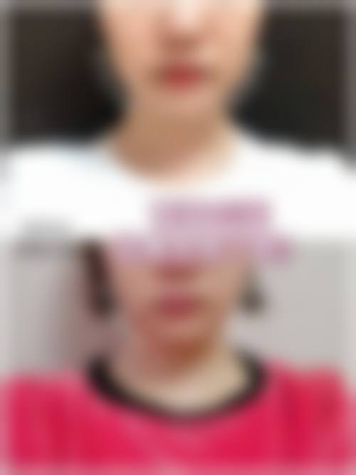 张哲医生可定制的医美项目