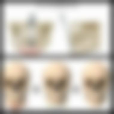 泰国拉蒂安医疗整形中 心怎么样来院路线