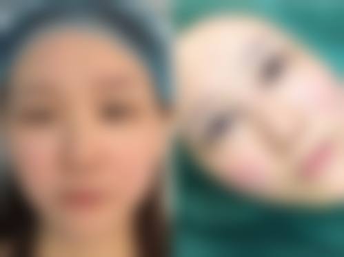 临沂瑞丽美容医院如何怎么样来院路线