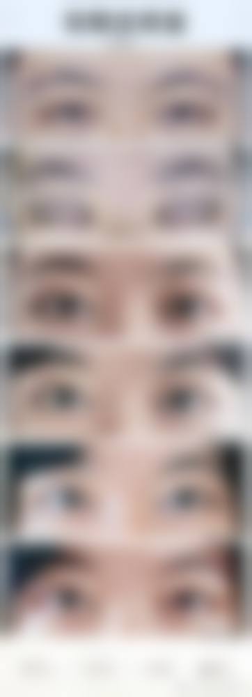 韩国纽莱茵整形医院怎么样求美者反馈