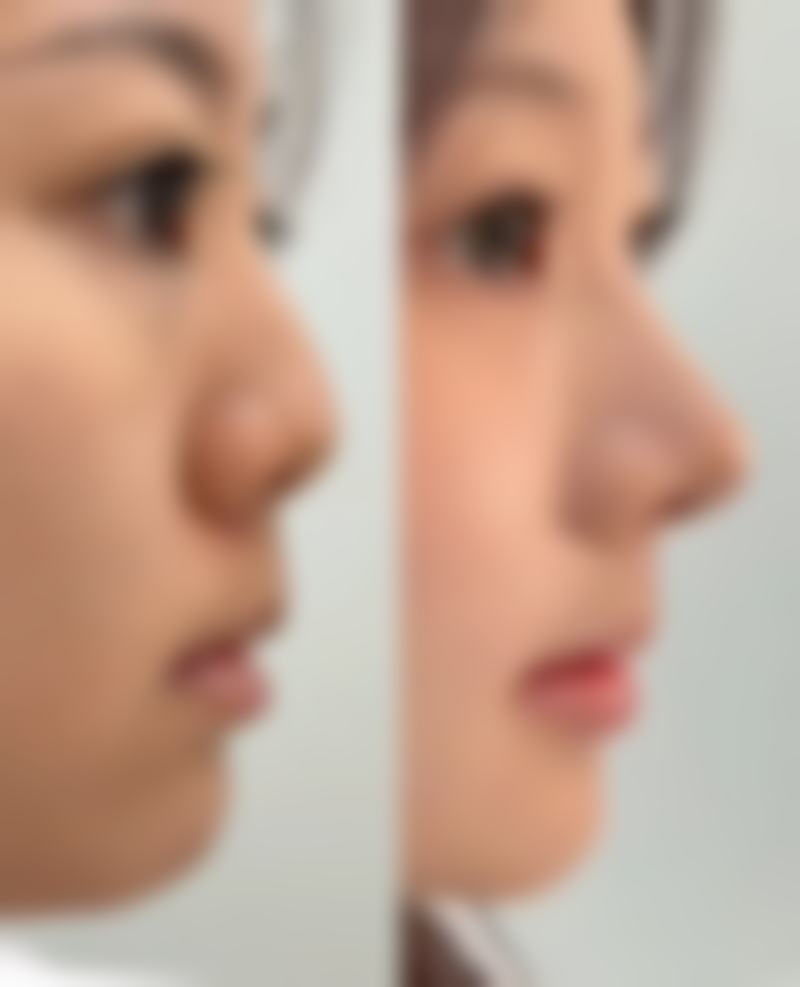 杜银燕助力您的美丽蜕变