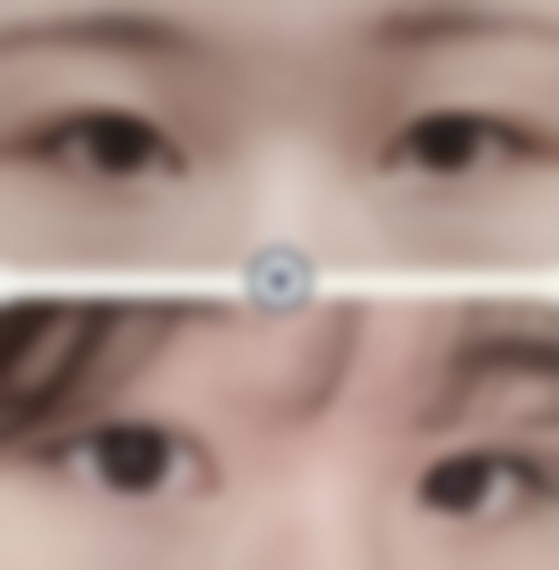 福州仁禾医疗美容怎么样求美者反馈