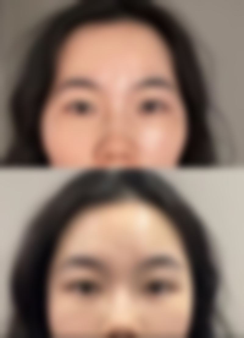 李德延的特色整形技术