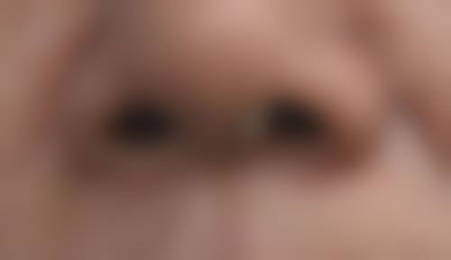 上海一美整形美容外科医院怎么样求美者反馈