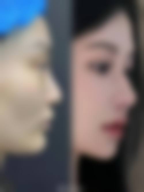 上海仁爱整形怎么样来院路线