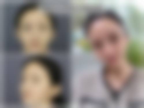 上海仁爱整形怎么样价格收费