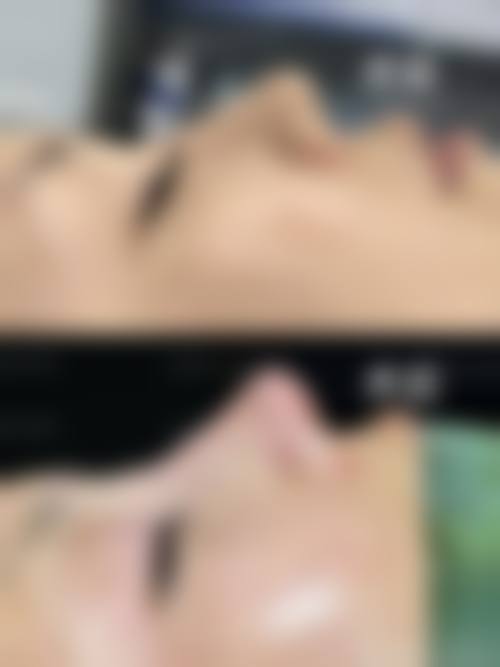 上海仁爱整形怎么样求美者反馈