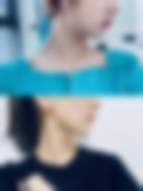 上海仁爱整形怎么样特色项目及技术优势