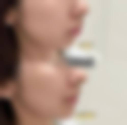 北京欧芭丽格医疗美容门诊部怎么样特色项目及技术优势