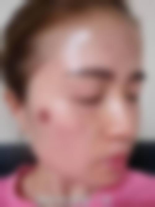 广州天河缔妍国内外医疗美容门诊部怎么样求美者反馈