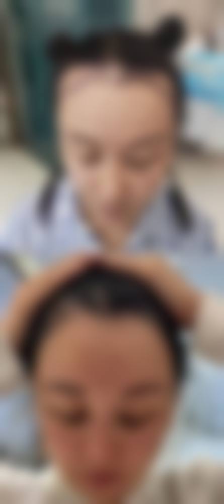 南通科禾植发怎么样特色项目及技术优势