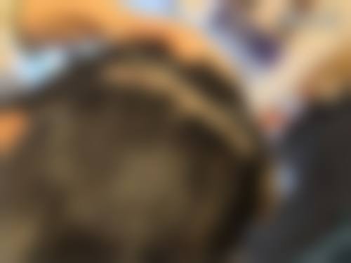 成都恒美植发连锁怎么样来院路线