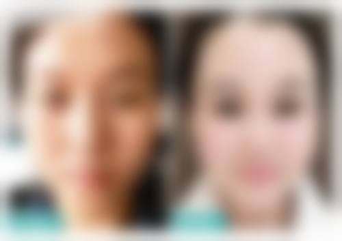 兰州圣莫丽斯美容门诊部怎么样价格收费