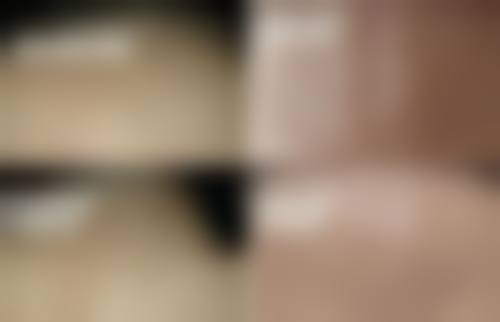 新疆维吾尔自治区人民医院整形科怎么样特色项目及技术优势