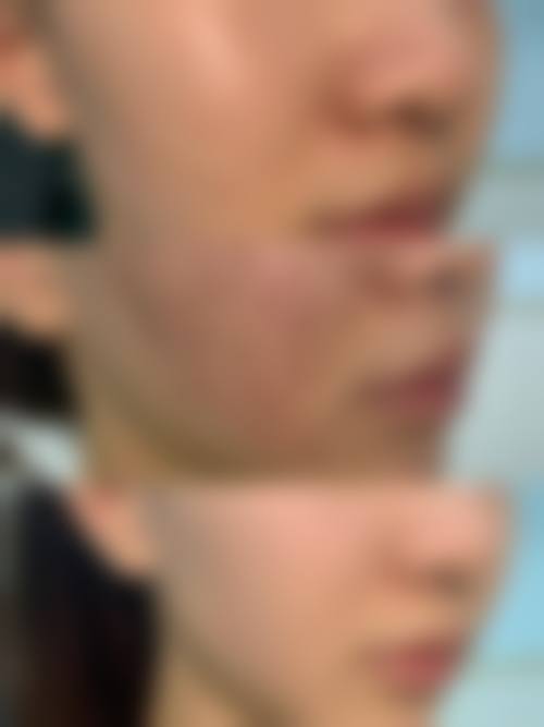 大连高岚医美怎么样价格收费