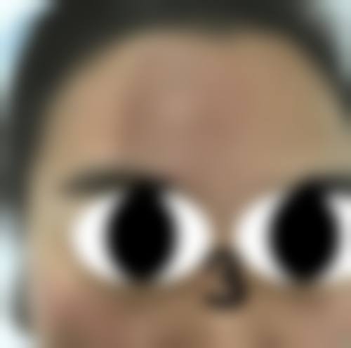 大连高岚医美怎么样求美者反馈