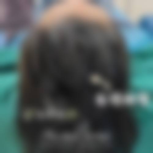 南通科禾植发怎么样求美者反馈