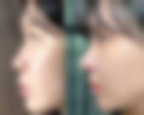 大连高岚医美怎么样特色项目及技术优势