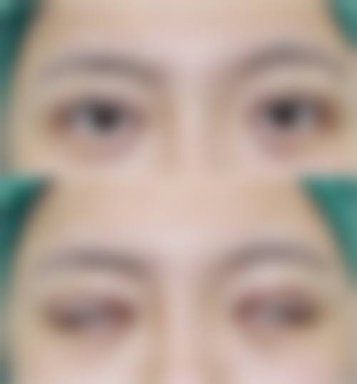 四平公主岭郭郭整形医院怎么样求美者反馈