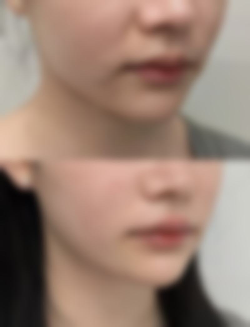 广州武警整形修复科研中 心怎么样医生团队实力