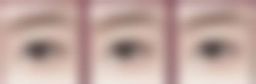 韩国美人整形外科医院怎么样求美者反馈