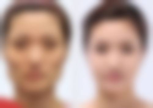 厦门大学附属东南医院烧伤整形科怎么样求美者反馈