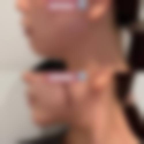 韩国美人整形外科医院怎么样医生团队实力