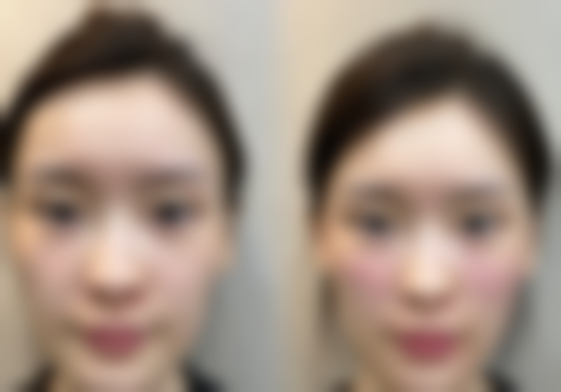 Herb整形外科怎么样来院路线