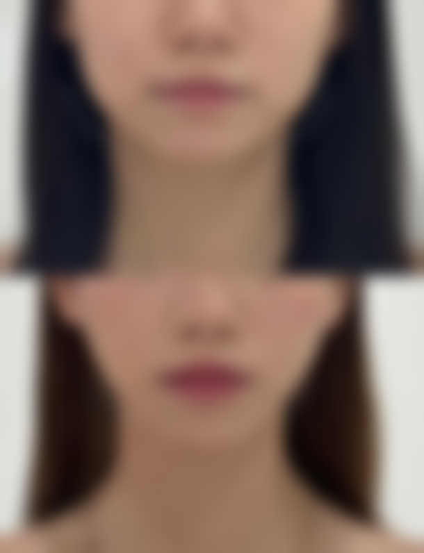 苏州伊美医疗美容诊所怎么样价格收费