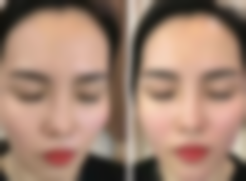 无锡小豚医疗美容诊所怎么样来院路线