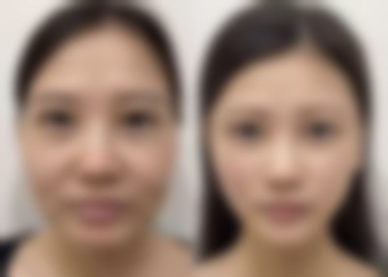 厦门大学附属东南医院烧伤整形科怎么样简介概述