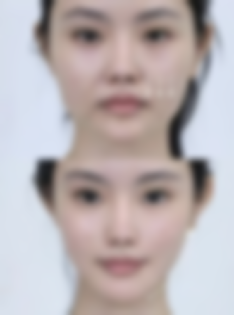 泉州亿星整形美容医院怎么样简介概述