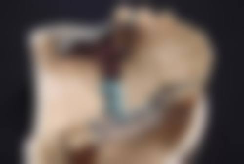 北京赵玉明整形医院怎么样医生团队实力