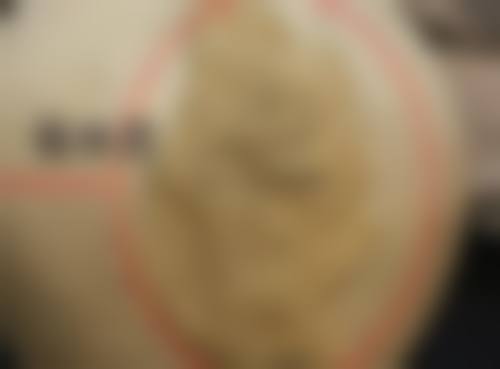 北京赵玉明整形医院怎么样求美者反馈